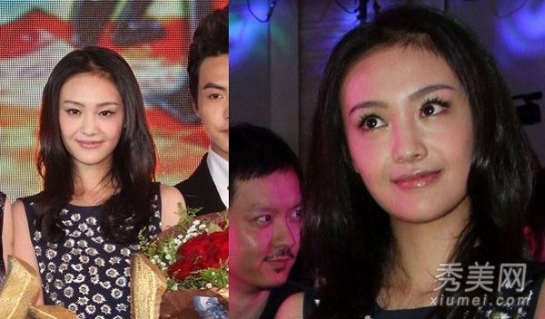 整容手术走得太远了。郑爽和袁珊珊长得很不一样。