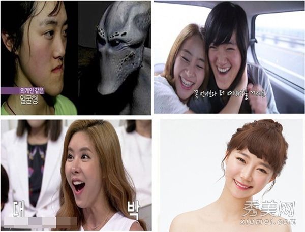 一名18岁的中国恐龙女去韩国整容，更换芭比娃娃60天