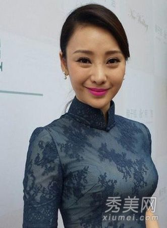 阿达最近被拍到的脸又肿又歪。谁比“整容手术”女演员更糟糕？