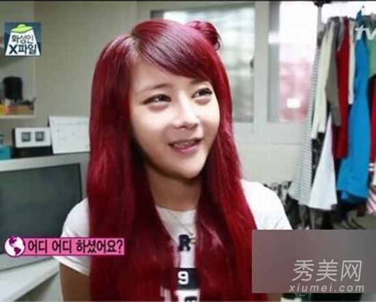 网络红人“整形中毒”病理整形案例