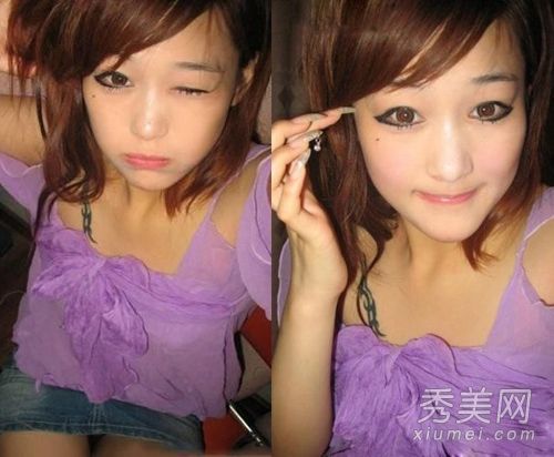 张馨的女演员杨蜜做整形手术的时候母亲没有认出来