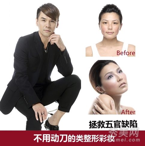 凯文老师的整形美容手术改善面部缺陷