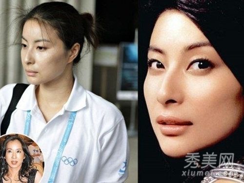 女明星变脸:王菲眼睛凸出郭晶晶的“蛤蟆嘴”