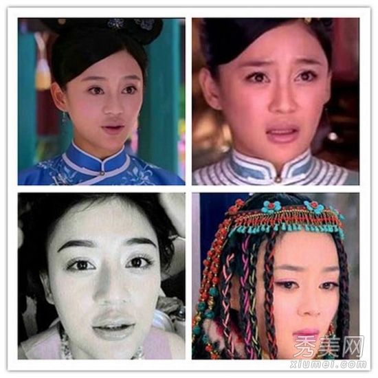 从整容手术到毁容,再到揭示女演员外貌的惊人变化