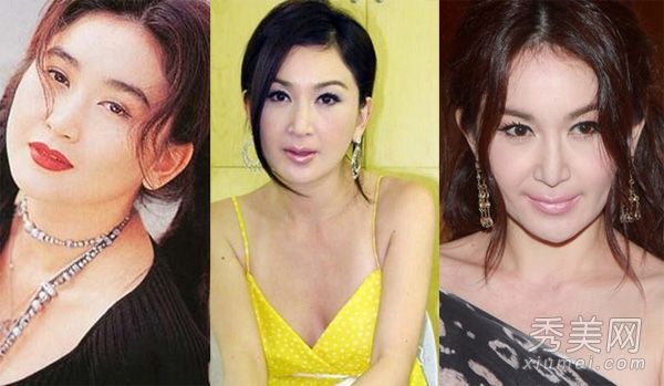 整容女演员暴露疤痕僵尸脸后遗症