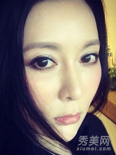 双眼皮手术:哪种双眼皮最适合你？