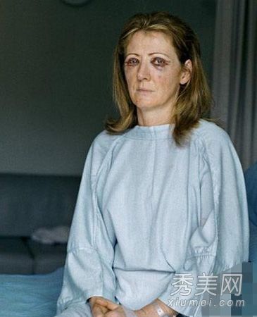 英国摄影师记录疯狂整容外科医生