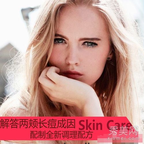 祛痘偏方:4种针对脸颊粉刺的祛痘配方