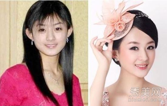 “吕真”赵坐在舞台上整容前暴露旧照片