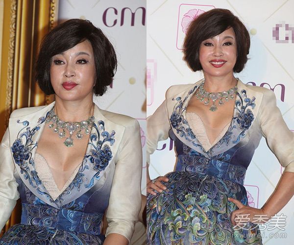 刘晓庆僵硬的脸真是说来话长！