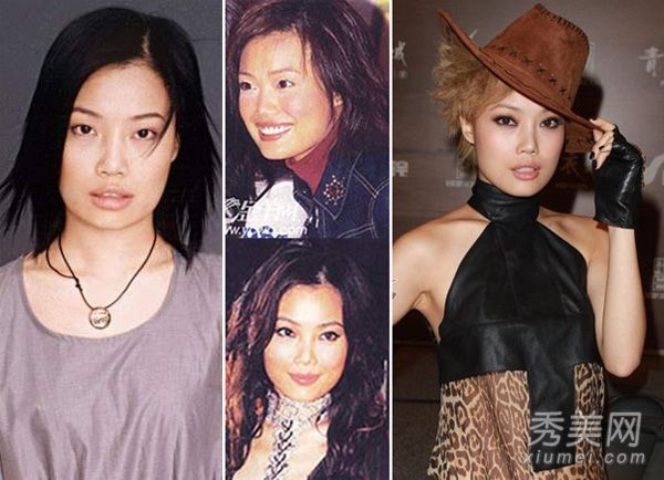 照片揭示小容祖儿、港台女演员整容和隆胸的真相