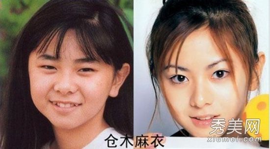 名人整容手术:十位日本名人喜欢在哪里治疗？