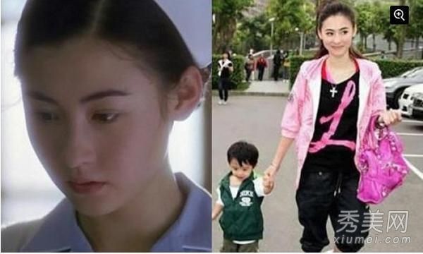 张柏芝“整容”明星霍思言往昔照片比较
