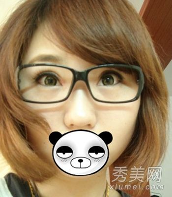 MM声称在割双眼皮的过程中整形手术失败了？