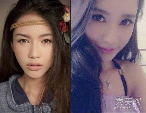 潘霜霜宝宝的面对面照片广为流传谁做过整形手术？