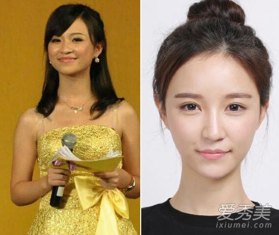 “整容改变命运”王思聪的女朋友都是人造美女吗?