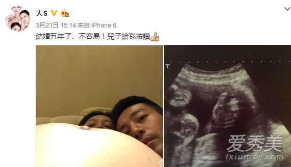 大S有第二个孩子，而且性格好。邢的第二代有一张可爱的脸，因为她温柔的母亲！