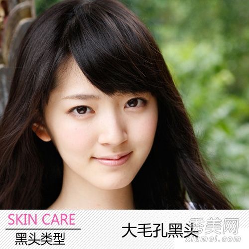 护肤技巧:如何减少毛孔和去除黑头？