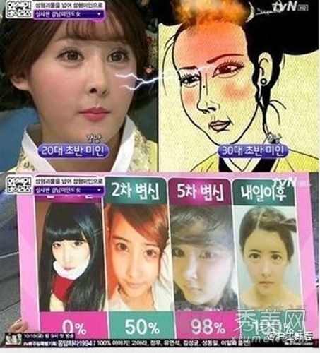 韩国女性爱上整形手术28次