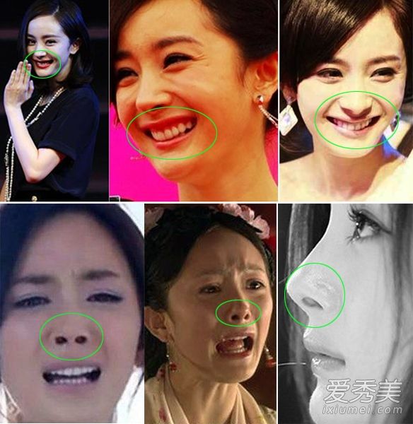 女演员的脸部死角:杨幂癞蛤蟆嘴，大鼻子，婴儿凸下巴