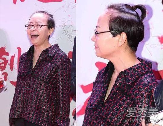 发际线向后移动1厘米，面部价值下降20分。