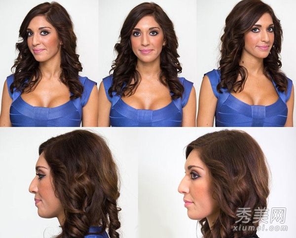 整容手术:照片显示女演员高价隆鼻