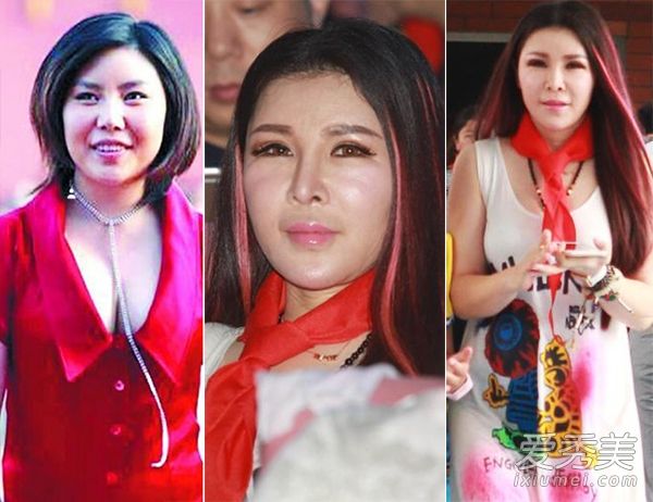 超女纪敏佳10年的整形手术没有被她的父母认可
