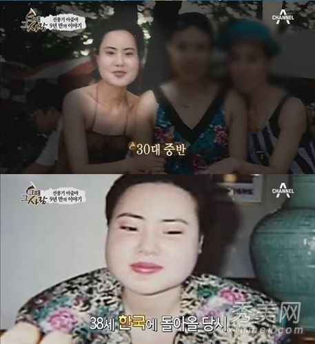 谁是2013年娱乐圈整容手术的“毁容”模特