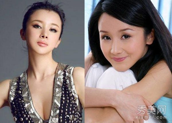 厚唇女演员:谁是整形外科?谁出生了?