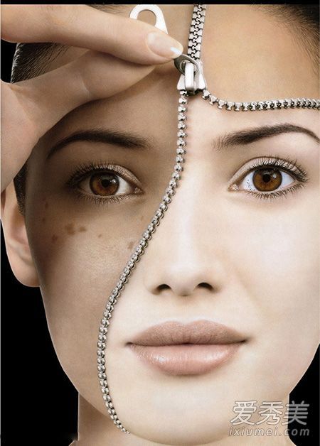 祛斑技术美白无瑕