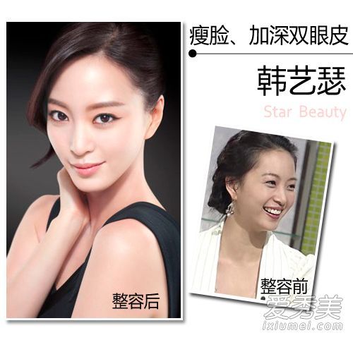 美容是由整容手术产生的?韩国女演员揭示整形外科的地位