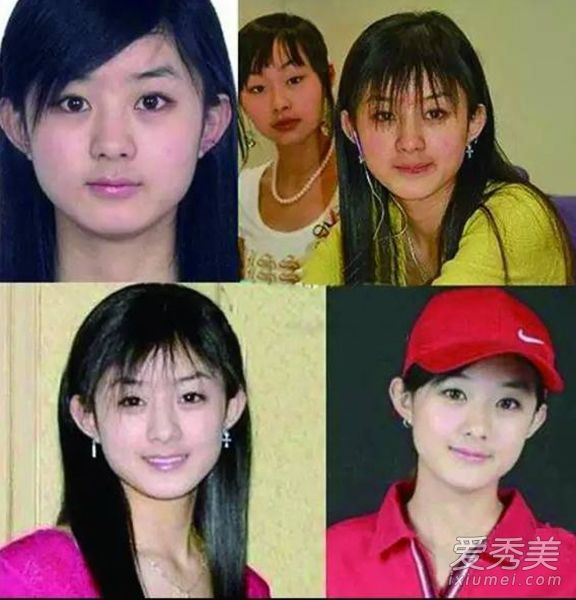 赵的老照片，华，被剥去衣服，用一根细针打去双眼皮？