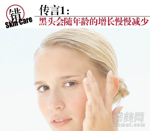 如何去除黑头？您是使用导出解决方案来移除还是？