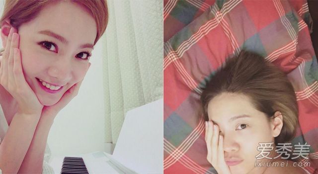 这是挤压粉刺的唯一方法！那些皮肤好的人永远不会做这些事情。