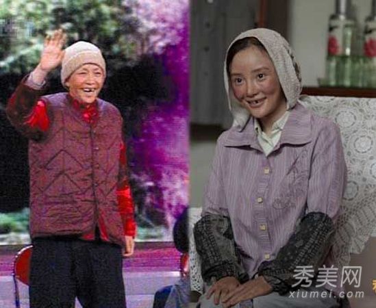 李小璐的“私人定制”整形手术变得僵硬，面容难看，引人注目