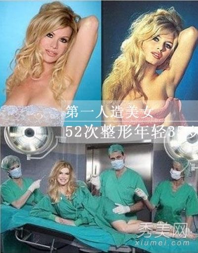 第一个人造美女在18年内接受了52次整形手术，现在已经变成了芭比娃娃。