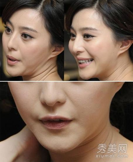 章子怡、范冰冰，未老先衰；暴露10年的颈条