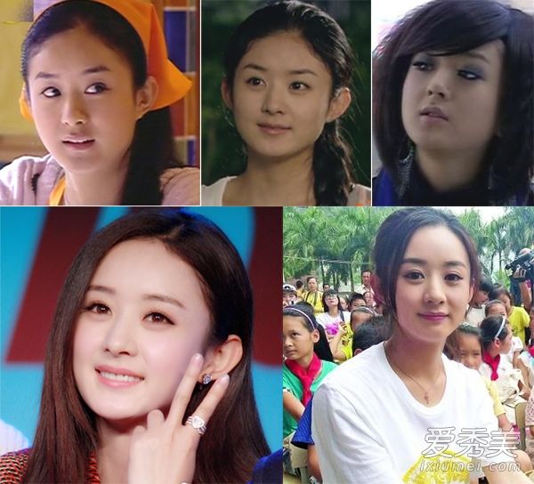 赵、娜娜、杜海涛亲自示范减肥=整形手术(照片)