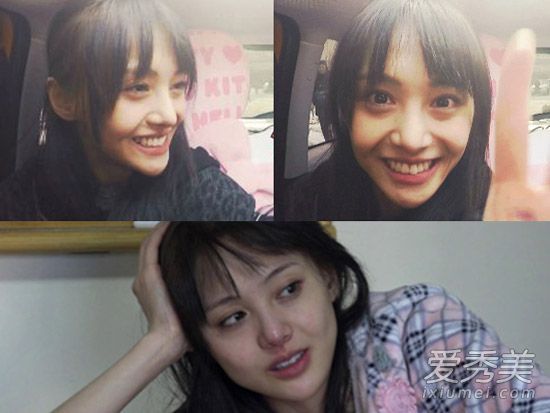 旋风孝子郑爽变成“瘾君子女孩”黑眼圈太吓人了