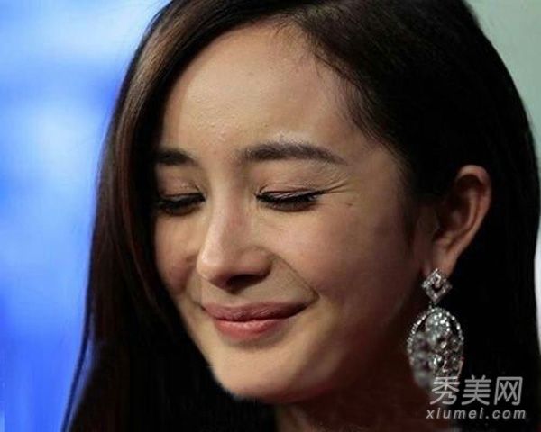 九大名人未老先衰杨汤米颜皱纹伤疤露