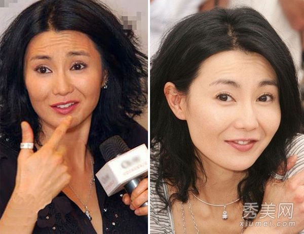 年纪较大的女演员贪婪地接受整形手术，成为“假面”