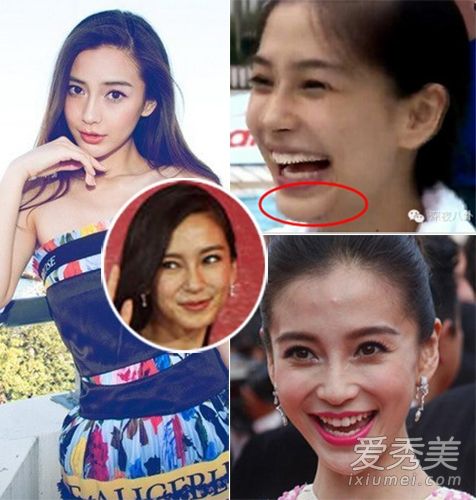 吴佩慈宋茜宝贝杨蜜笑毁颜值变傻大姑娘