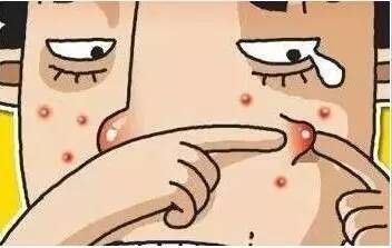 江苏小伙子挤痘痘哪里挤不出痘痘得败血症？