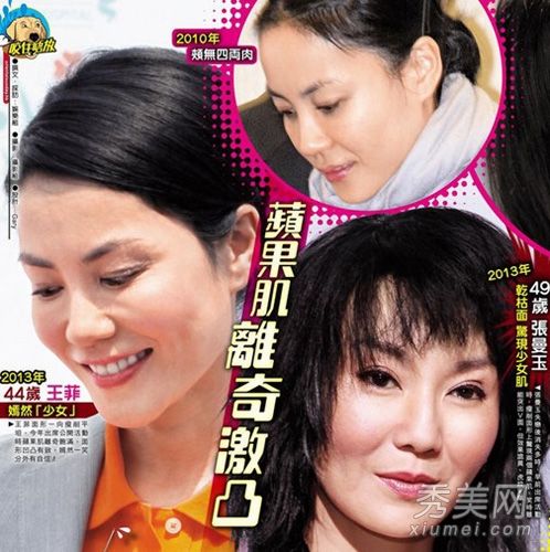 《娃娃脸》女主角大王菲整容前后痴迷美容针