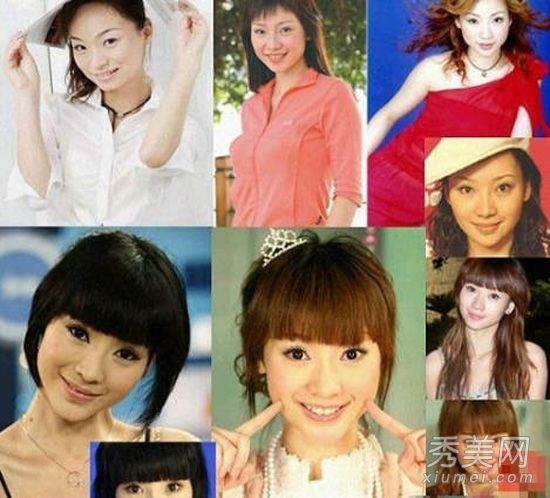 阿达早期才艺展示的旧照片被当作整容手术+丰胸来传递