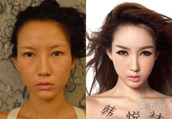 陈一曼想要红色和非道德行为的全像+整形手术+处女膜修复