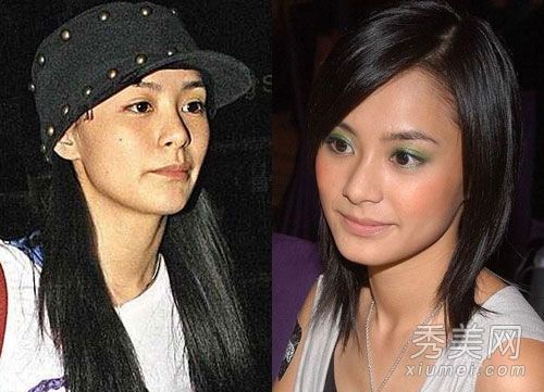 女演员卸妆后也有皮肤问题、粉刺和斑点(照片)