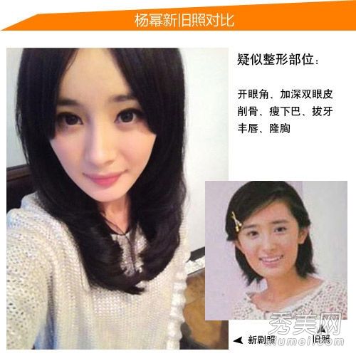 杨蜜，赵，，谁更难整容？