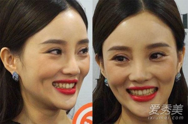 李小璐怀疑整容过度，面部僵硬变成“雕刻脸”