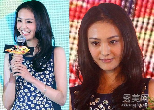 整容手术失败+长胖越长越丑女演员